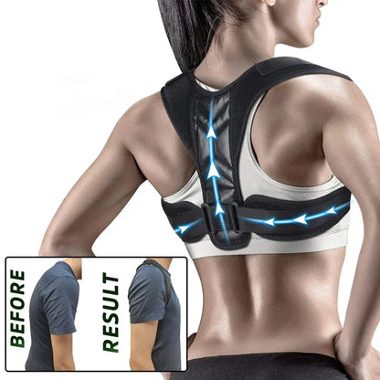 Back Posture Corrector